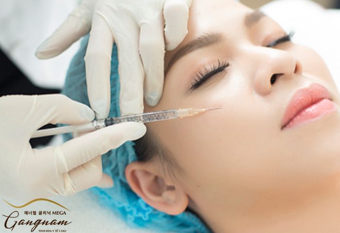 Một số lưu ý cần biết sau khi tiêm filler