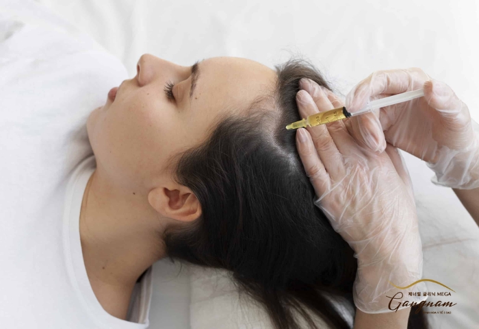 Phương pháp PRP có thể được áp dụng cho cả mục đích mọc tóc, trị hói đầu