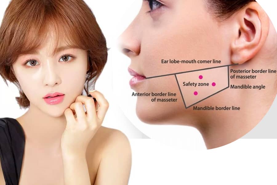 Botox được ứng dụng đặc biệt nhiều trong lĩnh vực thẩm mỹ