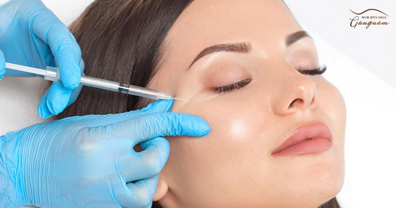 Tiêm botox tạm thời ngăn chặn cơn cơ và giảm nếp nhăn mắt ngay tức thì