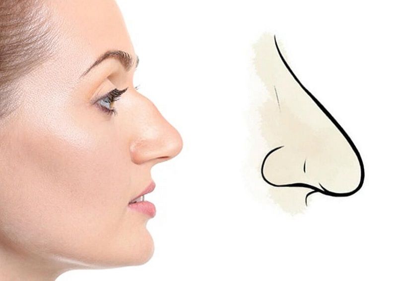 Những trường hợp nên phẫu thuật hạ thấp sống mũi 