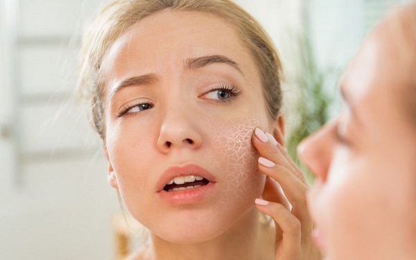 Da khô khiến gương mặt bạn nhanh lão hóa và tác động xấu đến sức khỏe & ngoại hình