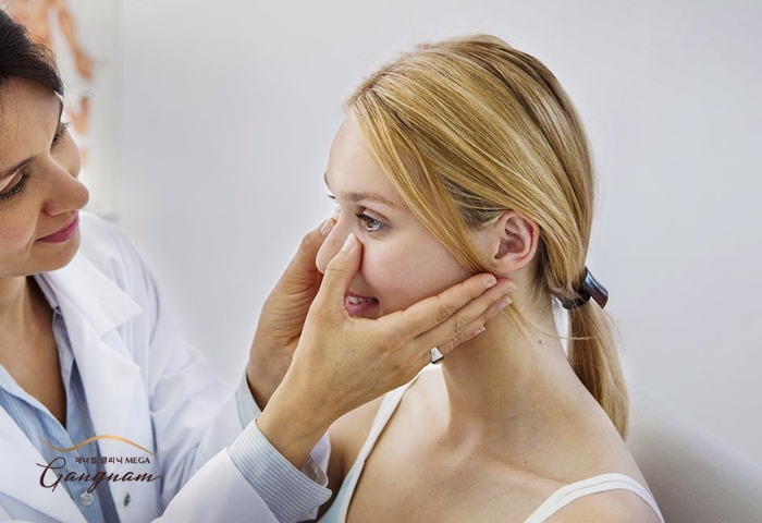 Điều trị lệch vách ngăn mũi bằng phương pháp nào tốt?