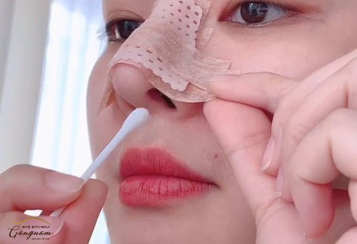 Cách chăm sóc mũi sau khi phẫu thuật chuẩn nhất