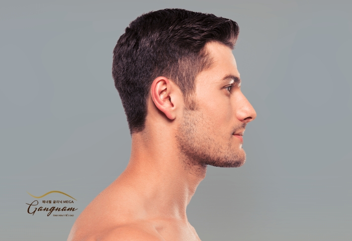 Gợi ý phương pháp nâng mũi nam phù hợp, cho dáng mũi cực tự nhiên