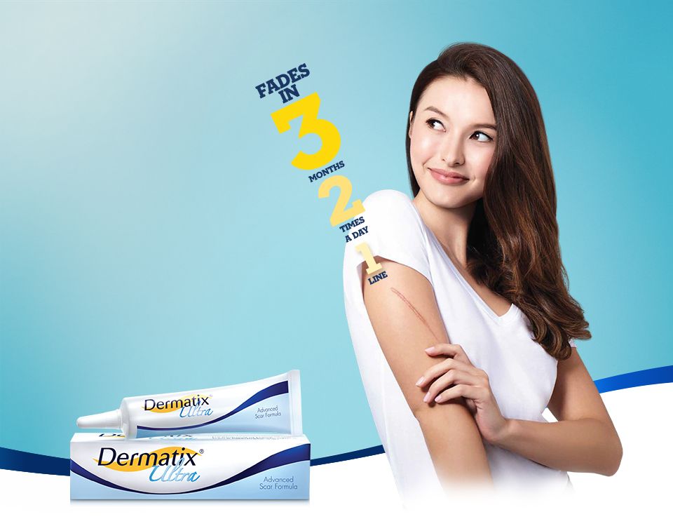 Dùng thuốc trị sẹo Dermatix trị được loại sẹo nào và bao lâu thì khỏi?