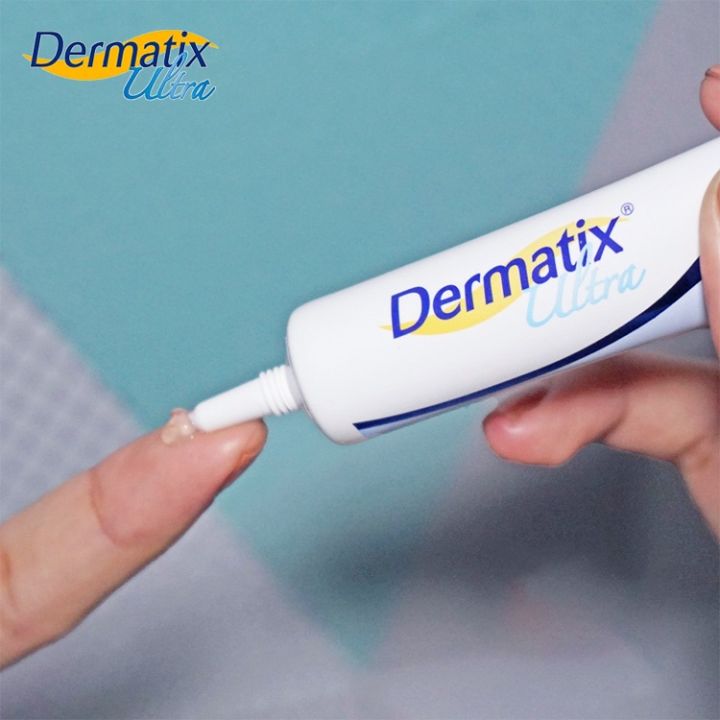 Giải đáp chi tiết từ chuyên gia: Dùng thuốc trị sẹo Dermatix bao lâu thì khỏi?