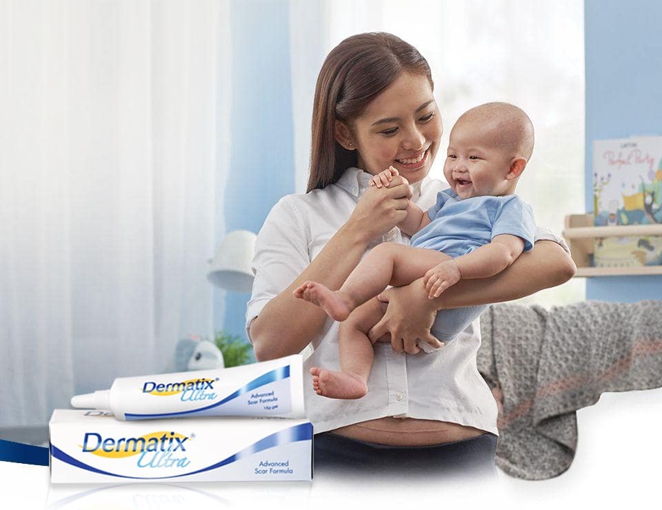 Thuốc bôi trị sẹo Dermatix an toàn với cả phụ nữ mang thai và cho con bú