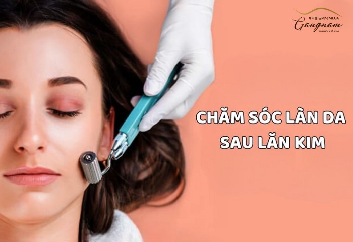 Cách chăm sóc da non sau khi lột, peel da, lăn kim