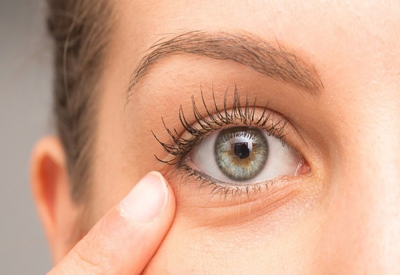 Thức khuya hay lão hóa khiến vùng da quanh mắt của bạn bị sâu, thâm quầng 