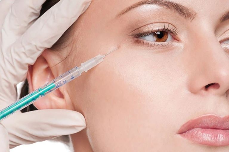 Tiêm filler để cải thiện đôi mắt tươi tắn hơn