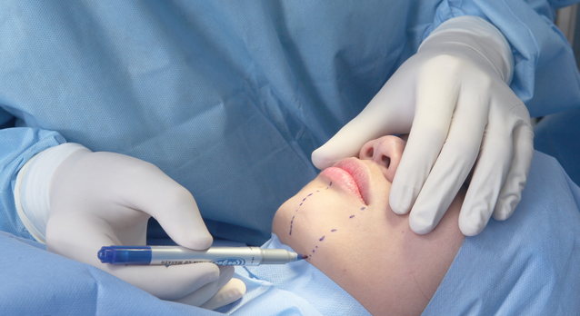 Phẫu thuật can thiệp xâm lấn để cải thiện góc mặt