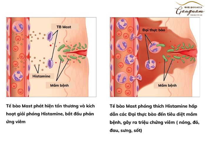 Quá trình liền vết thương hở