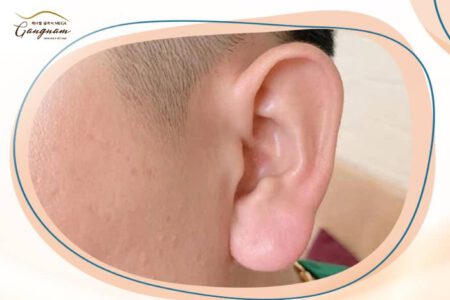 Dáng tai tài lộc là gì?