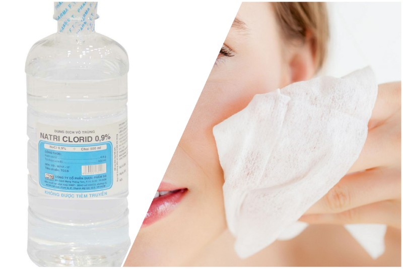 Dùng nước muối sinh lý để làm sạch da thay vì các sản phẩm hóa học khác sau khi làm đẹp từ máu tự thân