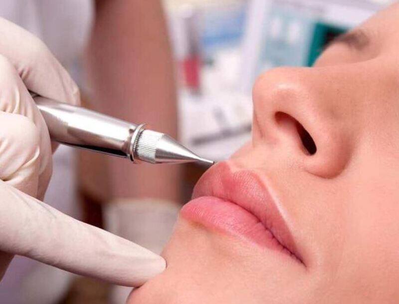 Cần can thiệp điều trị thâm môi bằng các phương pháp chuyên nghiệp hơn khi mức độ thâm khá nặng