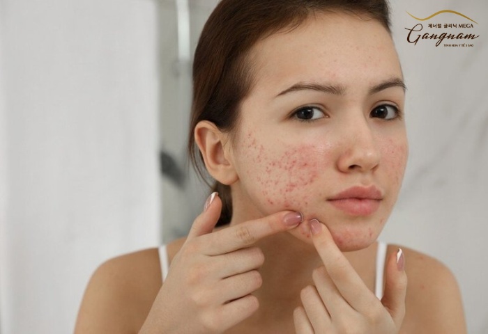 Cách nhận biết da mặt bị dị ứng mỹ phẩm