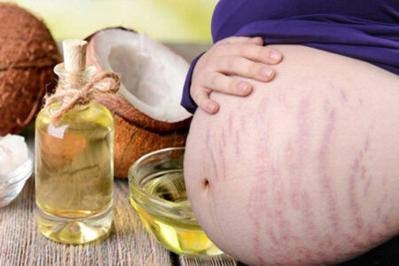 Hướng dẫn cách bôi dầu dừa trị rạn da cho phụ nữ sau sinh đúng cách