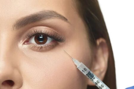 Quy trình thực hiện tiêm giảm thâm quầng vùng mắt