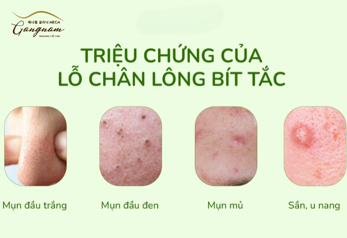 Tắc nghẽn lỗ chân lông