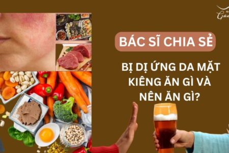 Bị dị ứng da mặt cần kiêng ăn gì và nên ăn gì?