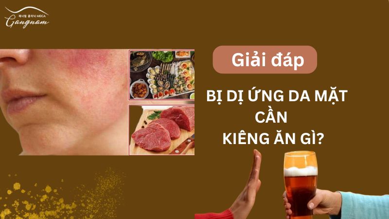 Thực phẩm cần kiêng ăn khi bị dị ứng da mặt