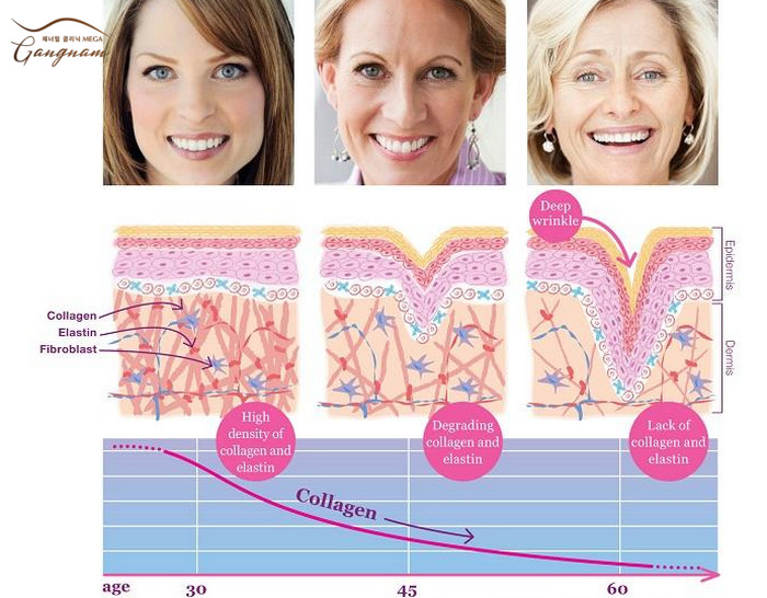 Sụt giảm collagen và elastin theo thời gian là nguyên nhân hàng đầu gây lão hóa