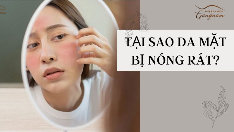 Tại sao da mặt bị nóng rát