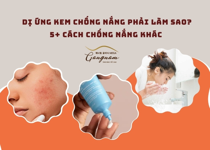 Làm gì khi bị dị ứng kem chống nắng?