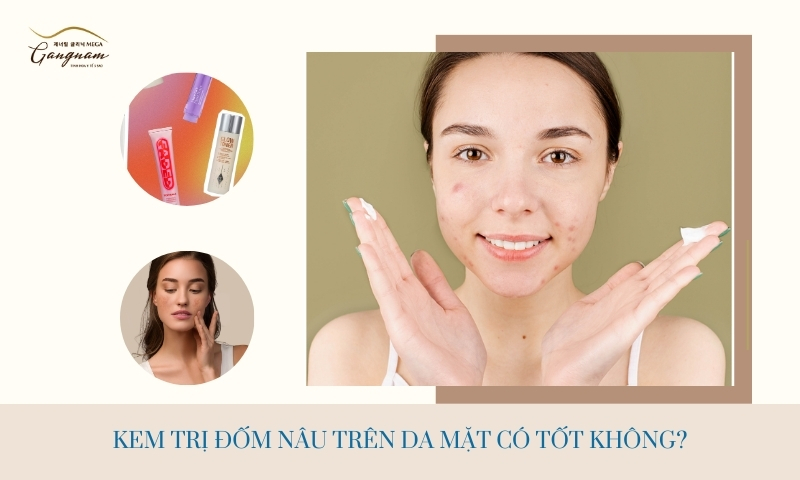 Dùng kem trị đốm nâu trên da mặt sản phẩm nào tốt và nên sử dụng nhất?