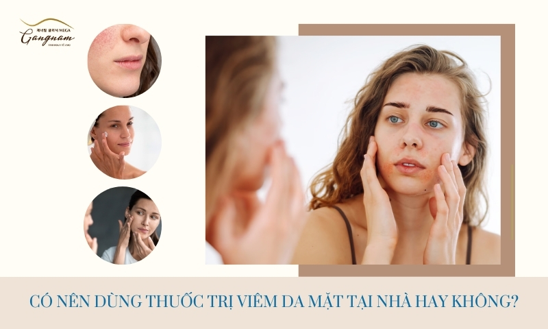 Các triệu chứng viêm da mặt thường gặp như thế nào? Dùng thuốc gì để điều trị? 