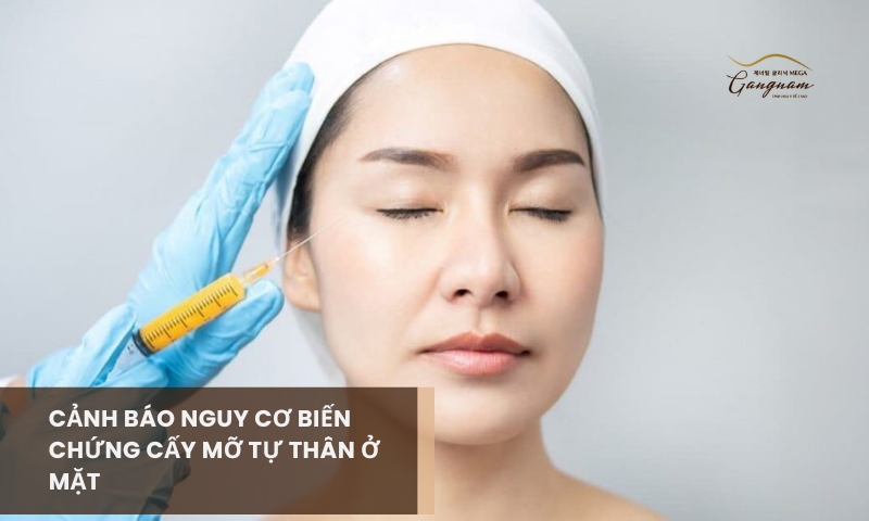 Biến chứng cấy mỡ tự thân biểu hiện như thế nào? Nguyên nhân trực tiếp là gì? 