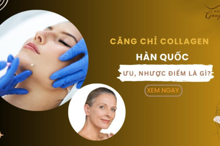 Căng chỉ collagen Hàn Quốc có ưu nhược điểm gì, ai nên thực hiện?