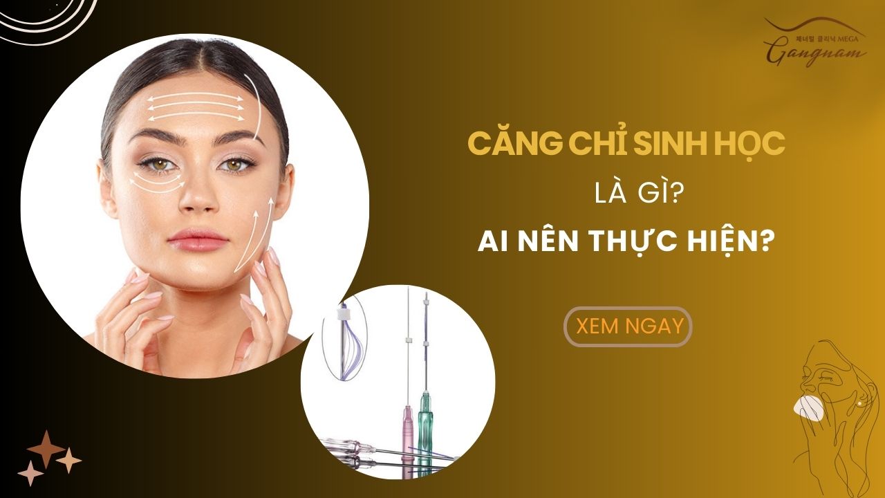 Căng chỉ sinh học là gì? Ai nên thực hiện?