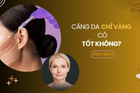 Căng da chỉ vàng có tốt không?