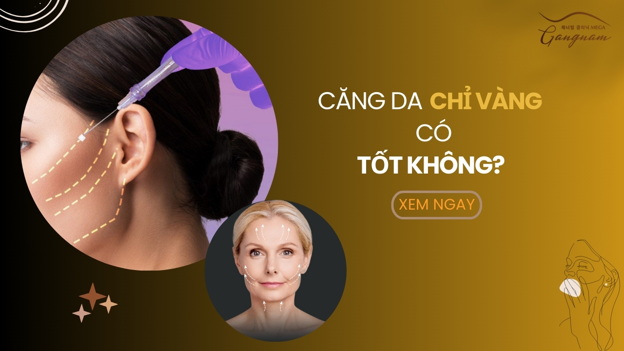 Căng da chỉ vàng có tốt không?