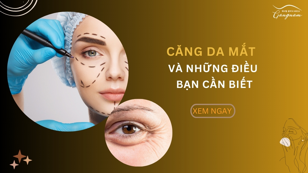 Những điều bạn cần biết về căng da mắt trẻ hóa