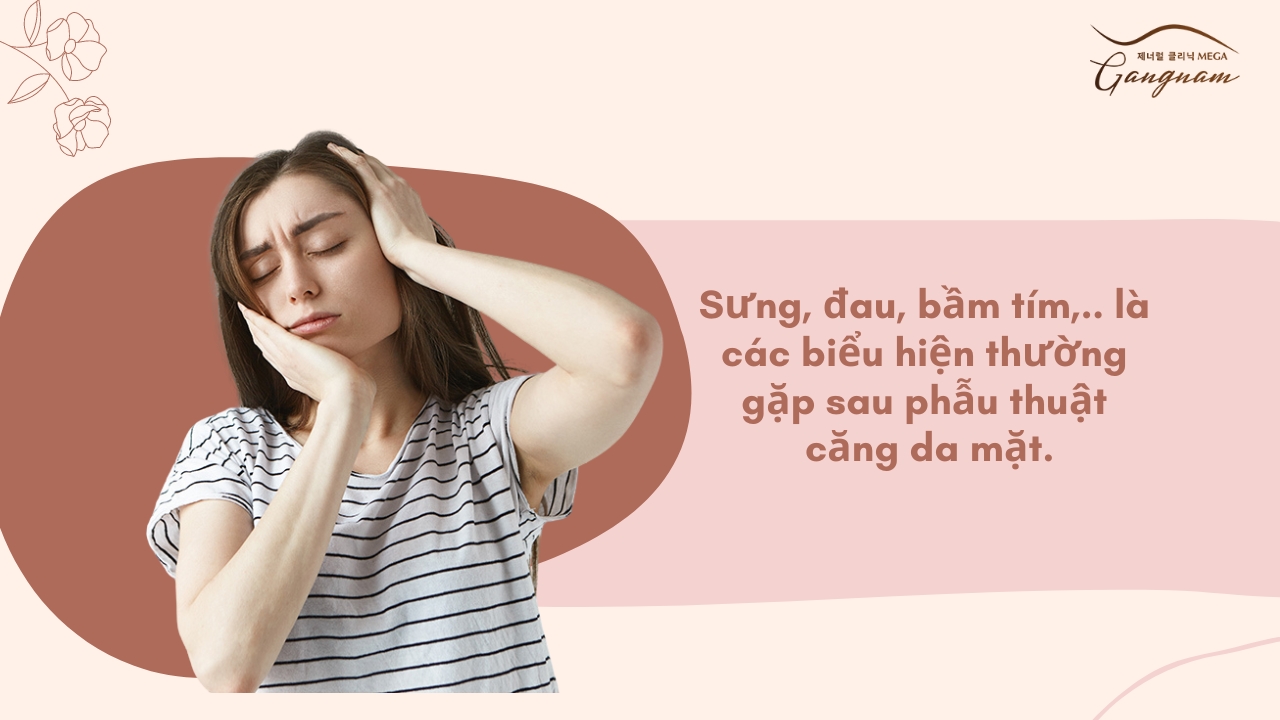 Sưng đau, bầm tím là các biểu hiện thường gặp sau phẫu thuật căng da. 