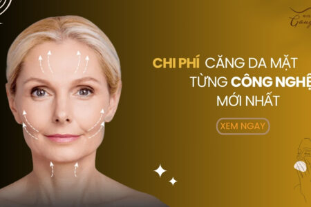 Chi phí căng da mặt cho từng công nghệ mới nhất