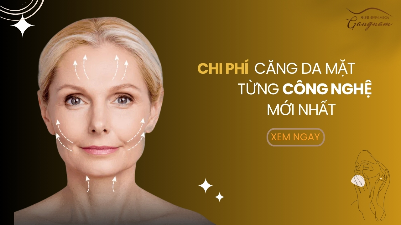 Chi phí căng da mặt cho từng công nghệ mới nhất