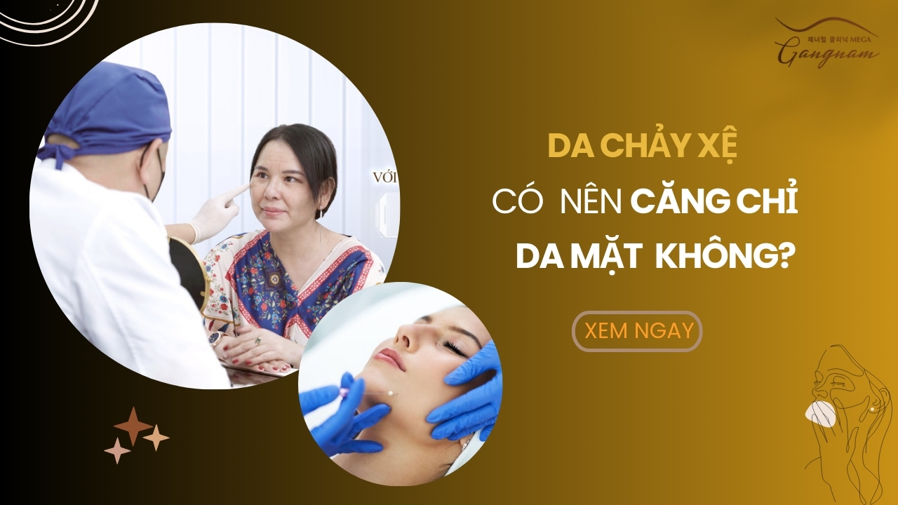 Da chảy xệ có nên căng chỉ da mặt không?