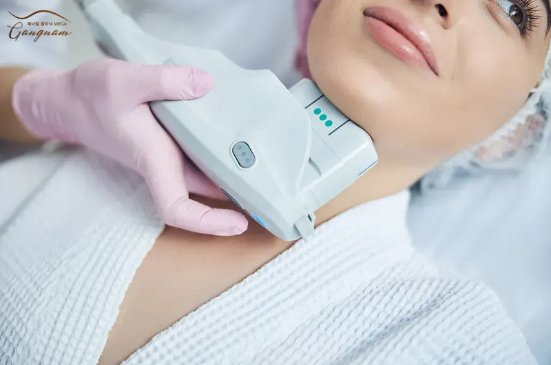 Ultherapy sử dụng sóng siêu âm hội tụ vi điểm để kích thích tăng sinh collagen căng da mặt.