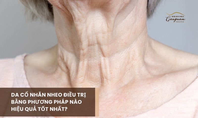 Nguyên nhân và hướng điều trị chính cho các trường hợp da cổ nhăn nheo là gì?