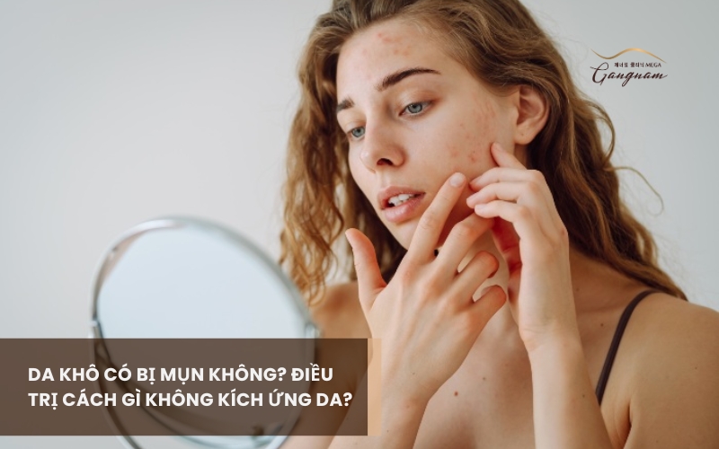 Giải đáp chi tiết da khô có bị mụn không và nguyên nhân là gì? 