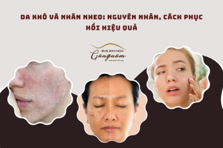 Da khô và nhăn nheo: Nguyên nhân, cách phục hồi hiệu quả