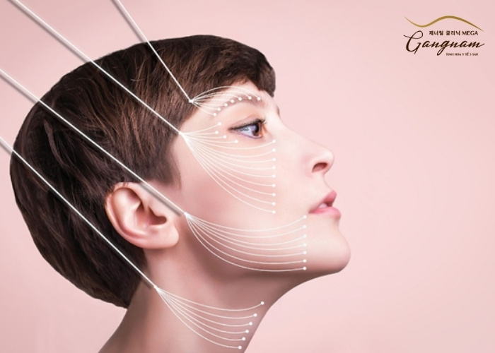 Đối tượng căng chỉ collagen