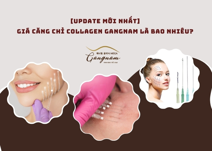 [Update mới nhất] Giá căng chỉ collagen Gangnam là bao nhiêu? 