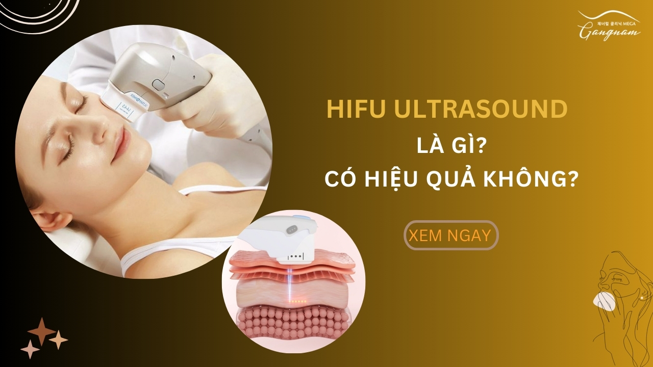 Hifu Ultrasound là gì? Có hiệu quả không?