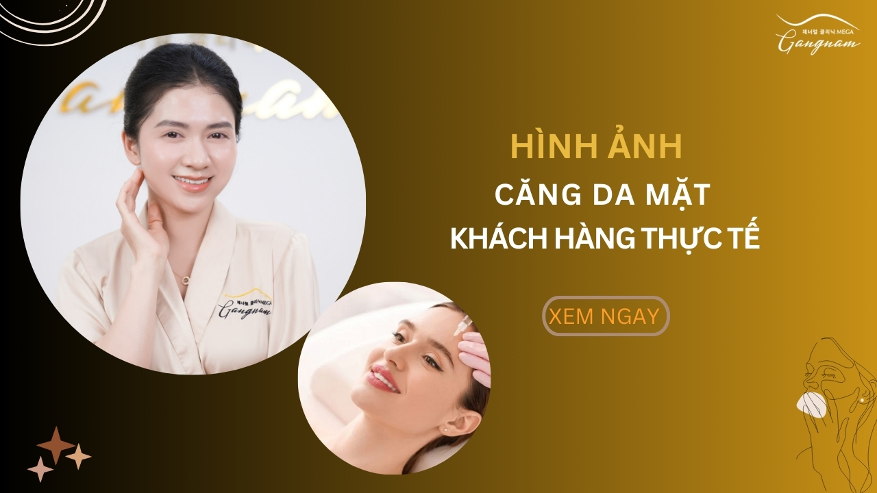 Thực tế hình ảnh căng da mặt từ khách hàng