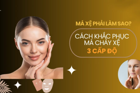 Má xệ phải làm sao?